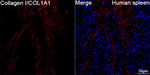 COL1A1 Antibody in Immunohistochemistry (Paraffin) (IHC (P))