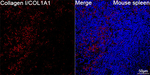 COL1A1 Antibody in Immunohistochemistry (Paraffin) (IHC (P))