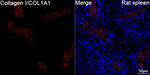 COL1A1 Antibody in Immunohistochemistry (Paraffin) (IHC (P))