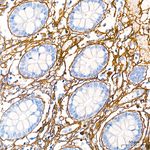 COL1A1 Antibody in Immunohistochemistry (Paraffin) (IHC (P))