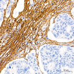 COL1A1 Antibody in Immunohistochemistry (Paraffin) (IHC (P))
