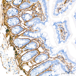 COL1A1 Antibody in Immunohistochemistry (Paraffin) (IHC (P))