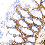 COL1A1 Antibody in Immunohistochemistry (Paraffin) (IHC (P))