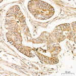FRS2 Antibody in Immunohistochemistry (Paraffin) (IHC (P))