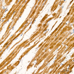 FRS2 Antibody in Immunohistochemistry (Paraffin) (IHC (P))