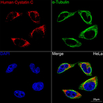 Cystatin C Recombinant Rabbit Monoclonal Antibody (6E5P5)