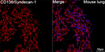 CD138 Antibody in Immunohistochemistry (Paraffin) (IHC (P))