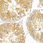 GTL3 Antibody in Immunohistochemistry (Paraffin) (IHC (P))