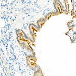 GTL3 Recombinant Rabbit Monoclonal Antibody (9D9J9)