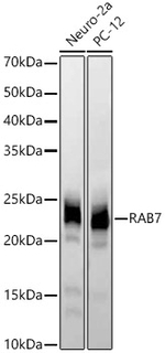 RAB7A Antibody in Western Blot (WB)