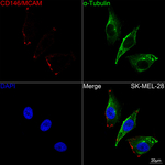 CD146 Recombinant Rabbit Monoclonal Antibody (1O4Y6)