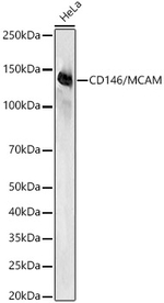 CD146 Antibody in Western Blot (WB)