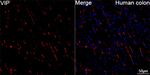 VIP Antibody in Immunohistochemistry (Paraffin) (IHC (P))