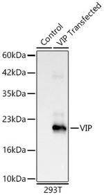 VIP Antibody in Western Blot (WB)