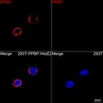PPBP Recombinant Rabbit Monoclonal Antibody (2O7H5)