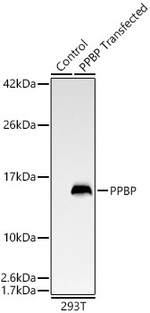PPBP Antibody in Western Blot (WB)