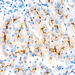 CD10 Antibody in Immunohistochemistry (Paraffin) (IHC (P))