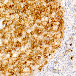 CD10 Recombinant Rabbit Monoclonal Antibody (9F1G7)