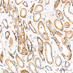 BCAM Antibody in Immunohistochemistry (Paraffin) (IHC (P))