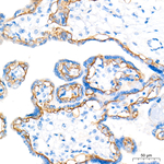 BCAM Recombinant Rabbit Monoclonal Antibody (7E5G9)