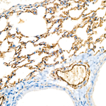 CD146 Antibody in Immunohistochemistry (Paraffin) (IHC (P))