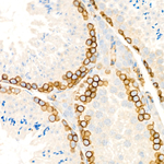 CD146 Recombinant Rabbit Monoclonal Antibody (0P2K3)
