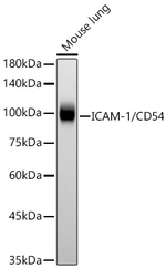 ICAM-1 Recombinant Rabbit Monoclonal Antibody (3C8E10)