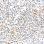 CD72 Recombinant Rabbit Monoclonal Antibody (4O5X4)
