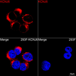 Kir3.2 (KCNJ6) Recombinant Rabbit Monoclonal Antibody (7X6I6)