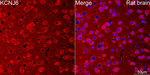 Kir3.2 (KCNJ6) Antibody in Immunohistochemistry (Paraffin) (IHC (P))