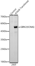 Kir3.2 (KCNJ6) Antibody in Western Blot (WB)