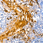 Mesothelin Antibody in Immunohistochemistry (Paraffin) (IHC (P))