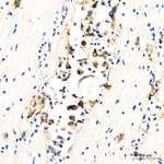 Mesothelin Recombinant Rabbit Monoclonal Antibody (5X7L7)