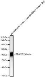 E-selectin Recombinant Rabbit Monoclonal Antibody (7M2C5)