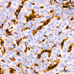 CD45 Antibody in Immunohistochemistry (Paraffin) (IHC (P))