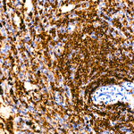 CD45 Antibody in Immunohistochemistry (Paraffin) (IHC (P))