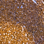 CD45 Antibody in Immunohistochemistry (Paraffin) (IHC (P))