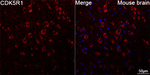 p35 Antibody in Immunohistochemistry (Paraffin) (IHC (P))