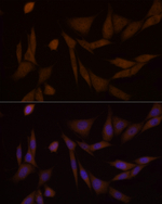 PFKFB3 Recombinant Rabbit Monoclonal Antibody (7C2F8)