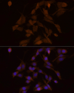 PFKFB3 Antibody in Immunocytochemistry (ICC/IF)