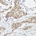 PFKFB3 Antibody in Immunohistochemistry (Paraffin) (IHC (P))