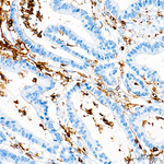 CD45 Recombinant Rabbit Monoclonal Antibody (5R2C3)