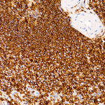 CD45 Antibody in Immunohistochemistry (Paraffin) (IHC (P))