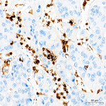 CD45 Antibody in Immunohistochemistry (Paraffin) (IHC (P))
