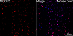 MECP2 Recombinant Rabbit Monoclonal Antibody (1P7A7)
