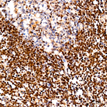 MECP2 Antibody in Immunohistochemistry (Paraffin) (IHC (P))