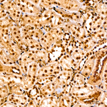 MECP2 Antibody in Immunohistochemistry (Paraffin) (IHC (P))