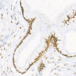 H3R17me2s Antibody in Immunohistochemistry (Paraffin) (IHC (P))