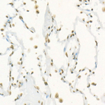 H3R17me2s Antibody in Immunohistochemistry (Paraffin) (IHC (P))