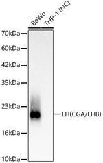 Luteinizing Hormone Antibody in Western Blot (WB)
